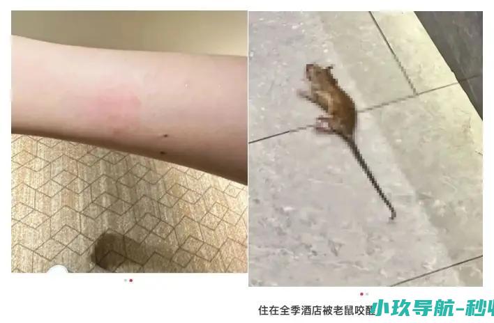 女子称入住全季酒店半夜被老鼠咬醒